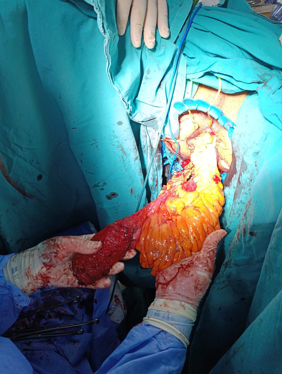 Salim İlksen Başçeken tweet media