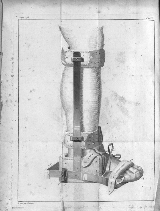 BibBellvitge's tweet photo. Antonio Scarpa (1752-1832) va ser un dels anatomistes més importants de la seva època. Moltes de les seves obres les tenim al @crai_ub i algunes d'elles digitalitzades a #BiPaDi. Com aquestes imatges de "Mémoires de physiologie et de chirurgie pratique"
➡️https://t.co/yAhChcuDas https://t.co/LRu2MewGIT