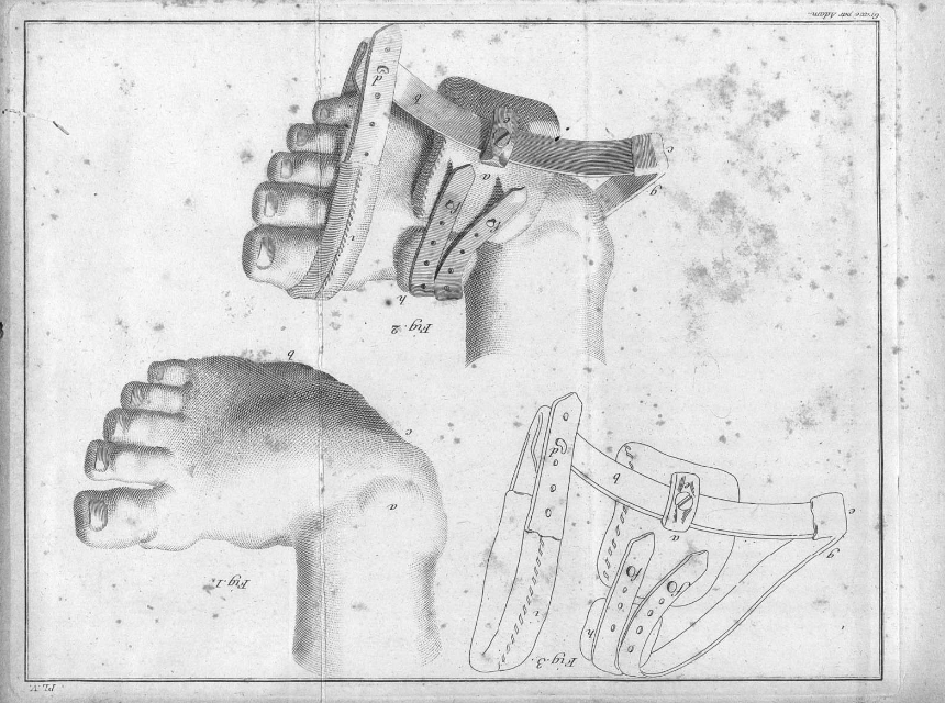 BibBellvitge's tweet photo. Antonio Scarpa (1752-1832) va ser un dels anatomistes més importants de la seva època. Moltes de les seves obres les tenim al @crai_ub i algunes d'elles digitalitzades a #BiPaDi. Com aquestes imatges de "Mémoires de physiologie et de chirurgie pratique"
➡️https://t.co/yAhChcuDas https://t.co/LRu2MewGIT