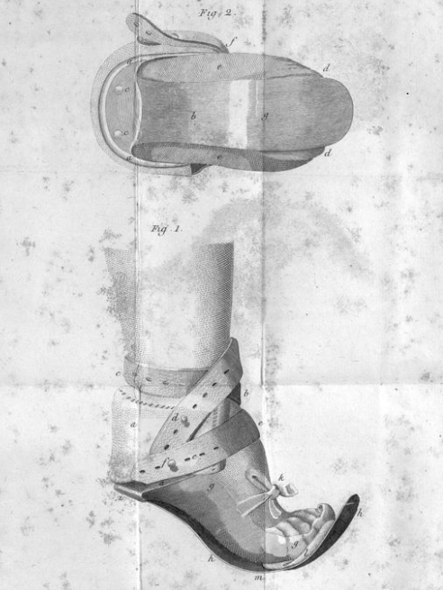 BibBellvitge's tweet photo. Antonio Scarpa (1752-1832) va ser un dels anatomistes més importants de la seva època. Moltes de les seves obres les tenim al @crai_ub i algunes d'elles digitalitzades a #BiPaDi. Com aquestes imatges de "Mémoires de physiologie et de chirurgie pratique"
➡️https://t.co/yAhChcuDas https://t.co/LRu2MewGIT