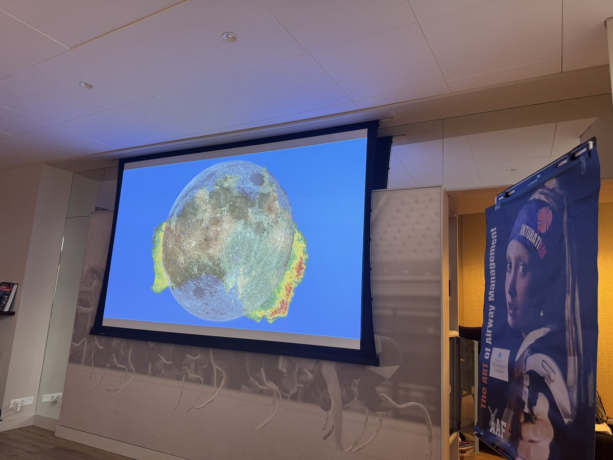 Hans Huitink (@airwaymxacademy) on Twitter photo <a href="/cliffreid/">Cliff Reid</a> Telling us #AAF24 that Australia is bigger than the moon and more interesting stuff of course #wow <a href="/jducanto/">James DuCanto, M.D.</a> <a href="/DaveOlvera1/">Dave Olvera</a> <a href="/rosshofmeyr/">Ross Hofmeyr</a> <a href="/ilsejans/">Ilse Jansma</a> <a href="/AnRocad/">Atropínico</a> <a href="/bobfunn/">bob funnekotter</a> <a href="/maffygirl/">Mary-Ann Fox</a> #airway <a href="/cliffreid/">Cliff Reid</a> Telling us #AAF24 that Australia is bigger than the moon and more interesting stuff of course #wow <a href="/jducanto/">James DuCanto, M.D.</a> <a href="/DaveOlvera1/">Dave Olvera</a> <a href="/rosshofmeyr/">Ross Hofmeyr</a> <a href="/ilsejans/">Ilse Jansma</a> <a href="/AnRocad/">Atropínico</a> <a href="/bobfunn/">bob funnekotter</a> <a href="/maffygirl/">Mary-Ann Fox</a> #airway