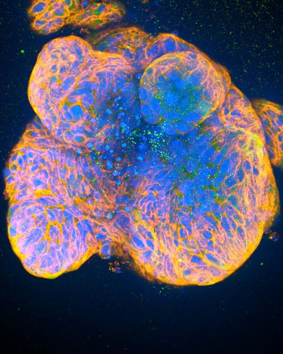 ⚡Research News ⚡

We’re delighted that work at the Milner Institute in collaboration with Professor Matthias Zilbauer has made a promising step toward identifying more precise and personalised treatments for patients with Crohn’s disease 👀

👉 milner.cam.ac.uk/milner-collabo…