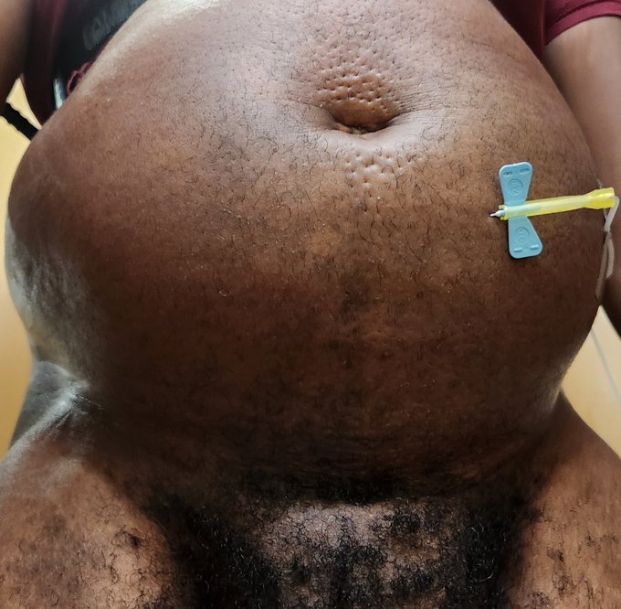 CW: needle this is to make up for not feeling well over the weekend. There are videos too, but having