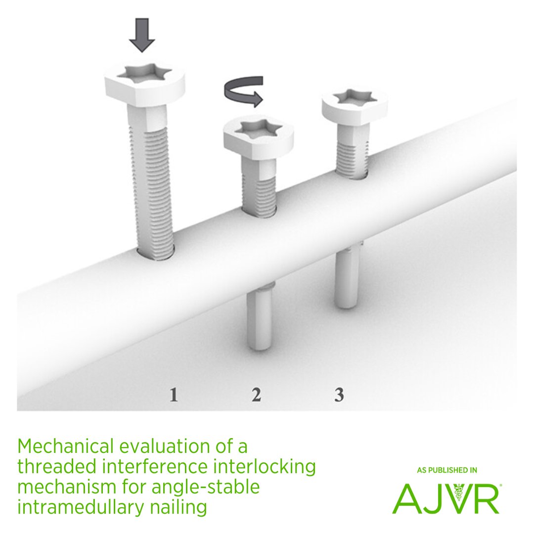 AJVROA's tweet image. The threaded interference design may be a suitable mechanism for generating angle stability in interlocking nails. Open access article: jav.ma/nails @ufvetmed @theacvs #interlockingnail #intramedullarynail #fracture #mechanicaltesting #anglestable
