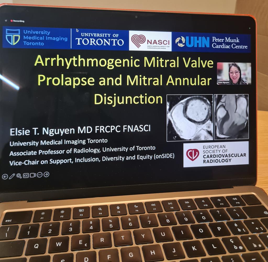 CarlottaOnnis's tweet image. Big thanks to @NASCISociety and  @EscrOffice and the incredible speakers @ElsieRadiology @prachipagarwal @LuigiaDerr Phillip Young for this wonderful webinar on mitral valve prolapse 🫀
#NASCI #ESCR