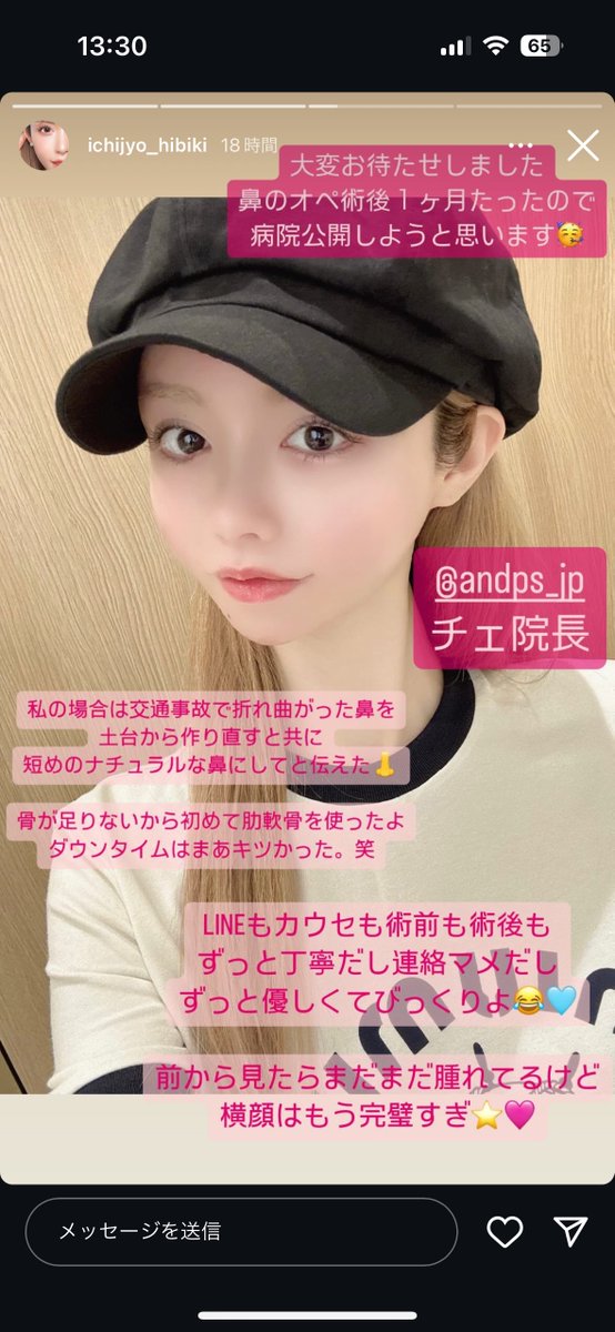 Narururu_v's tweet photo. ねぇ響ちゃんの鼻の病院公開されてた‼️韓国のANDのチェ先生。カウセ周りの時鼻の中の骨折れてたストーリー上げてたけど、土台から作り直し＆短めに修正したぽい。 https://t.co/eedQhS9Pkk