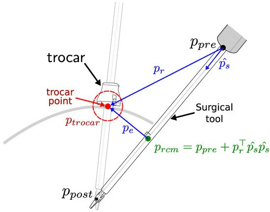 Sensors_MDPI's tweet image. A Concurrent Framework for Constrained Inverse Kinematics of Minimally Invasive Surgical Robots
mdpi.com/1424-8220/23/6…
#surgical robot; #inverse kinematics; #constrained motion planning; #minimally invasive surgery; #nonlinear optimization