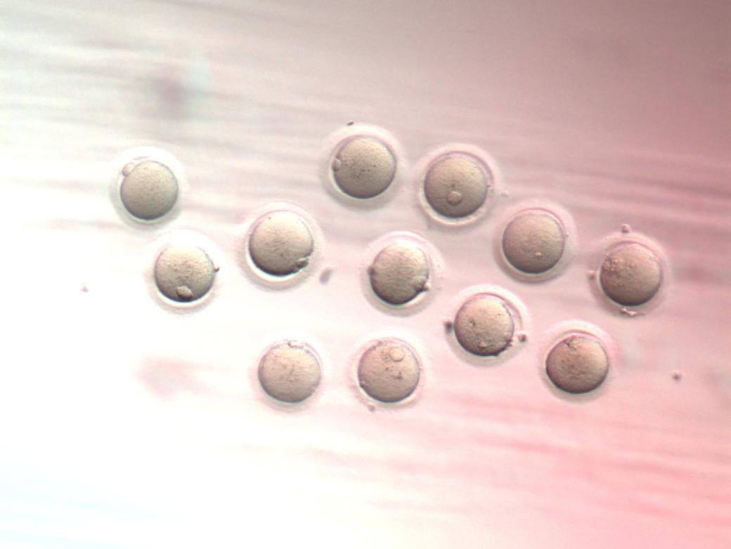 Ovarian Tissue Oocytes and CAPA-IVM