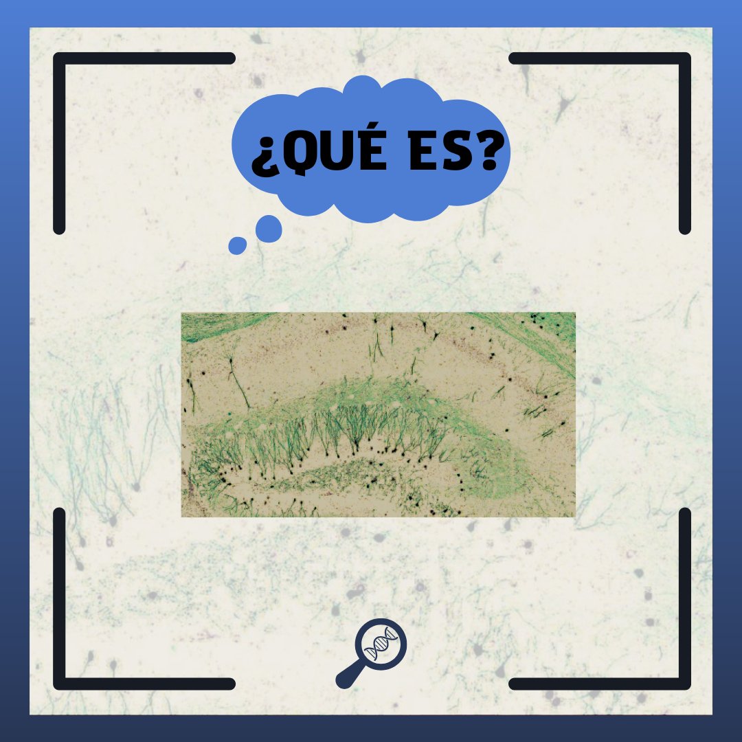 Aquí tenéis una imagen , ¿quién sabe qué es? Esta noche desvelamos la respuesta😱