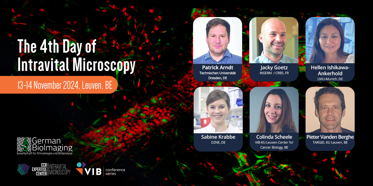 VIB Training & Conferences (@vibtrainconf) on Twitter photo 🚨Save the Date!🚨 Join us for The 4th Day of Intravital Microscopy on 13-14 November 2024 in Leuven. 🌍✨ Organized by <a href="/GerBI_GMB/">German BioImaging</a> in collaboration with <a href="/_Intravital/">Intravital Imaging Expertise Center</a>. Don’t miss out! More info at: vibconferences.be/events/the-4th… #IVMIC24 📅🔬 🚨Save the Date!🚨 Join us for The 4th Day of Intravital Microscopy on 13-14 November 2024 in Leuven. 🌍✨ Organized by <a href="/GerBI_GMB/">German BioImaging</a> in collaboration with <a href="/_Intravital/">Intravital Imaging Expertise Center</a>. Don’t miss out! More info at: vibconferences.be/events/the-4th… #IVMIC24 📅🔬