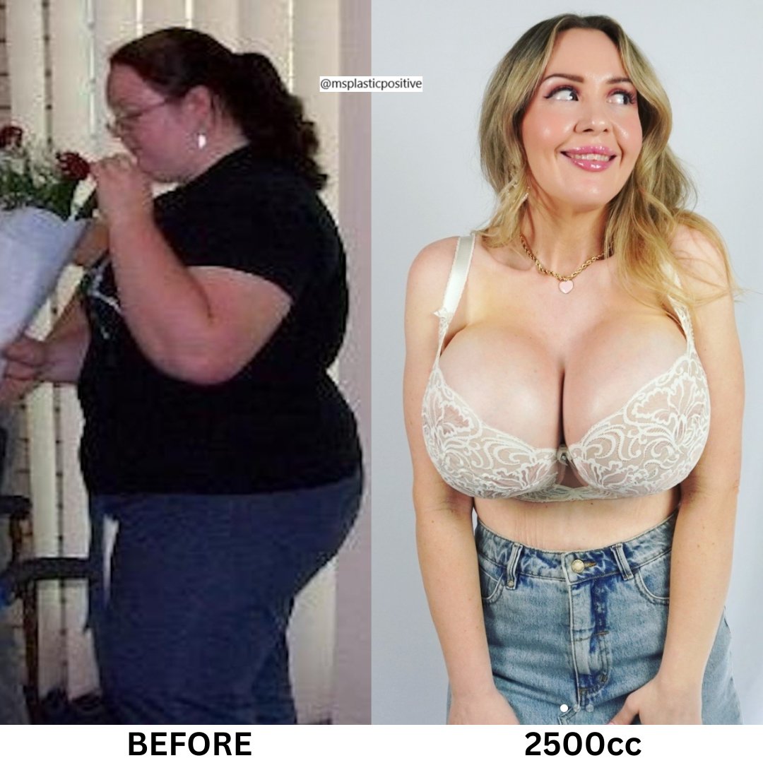 plastic_ms's tweet image. Follow @bimbowifemandy #plasticsurgery #cosmeticsurgery #bimbogirl #bimbobarbie #bimbo #bimbogoddess #BreastAugmentation #bigboobs #plasticlife #plasticdoll #plasticmakesperfect