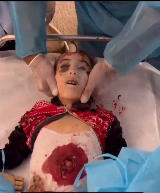 لا اعتذر لقساوة المشهد