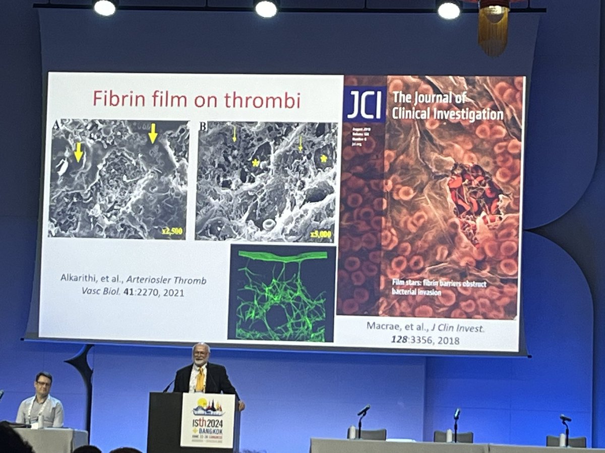 British Society for Haemostasis & Thrombosis (@britsochaemthro) on Twitter photo Characterisation of novel fibrin biofilms by <a href="/FibrinFraser/">Dr Fraser Macrae</a> <a href="/RobertAriens/">Robert Ariens</a> highlighted as in important discovery during Prof John Weisel’s plenary lecture at #ISTH2024 👏🤩 Characterisation of novel fibrin biofilms by <a href="/FibrinFraser/">Dr Fraser Macrae</a> <a href="/RobertAriens/">Robert Ariens</a> highlighted as in important discovery during Prof John Weisel’s plenary lecture at #ISTH2024 👏🤩