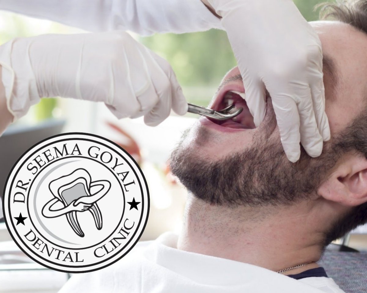 Why Do You Have to Remove Wisdom Teeth?
Removing your wisdom teeth is a preventive effort. Your mouth may be too small for them, and when the bones get harder in the later years, it would be tougher to remove. If you need to take your wisdom tooth out, we can help.