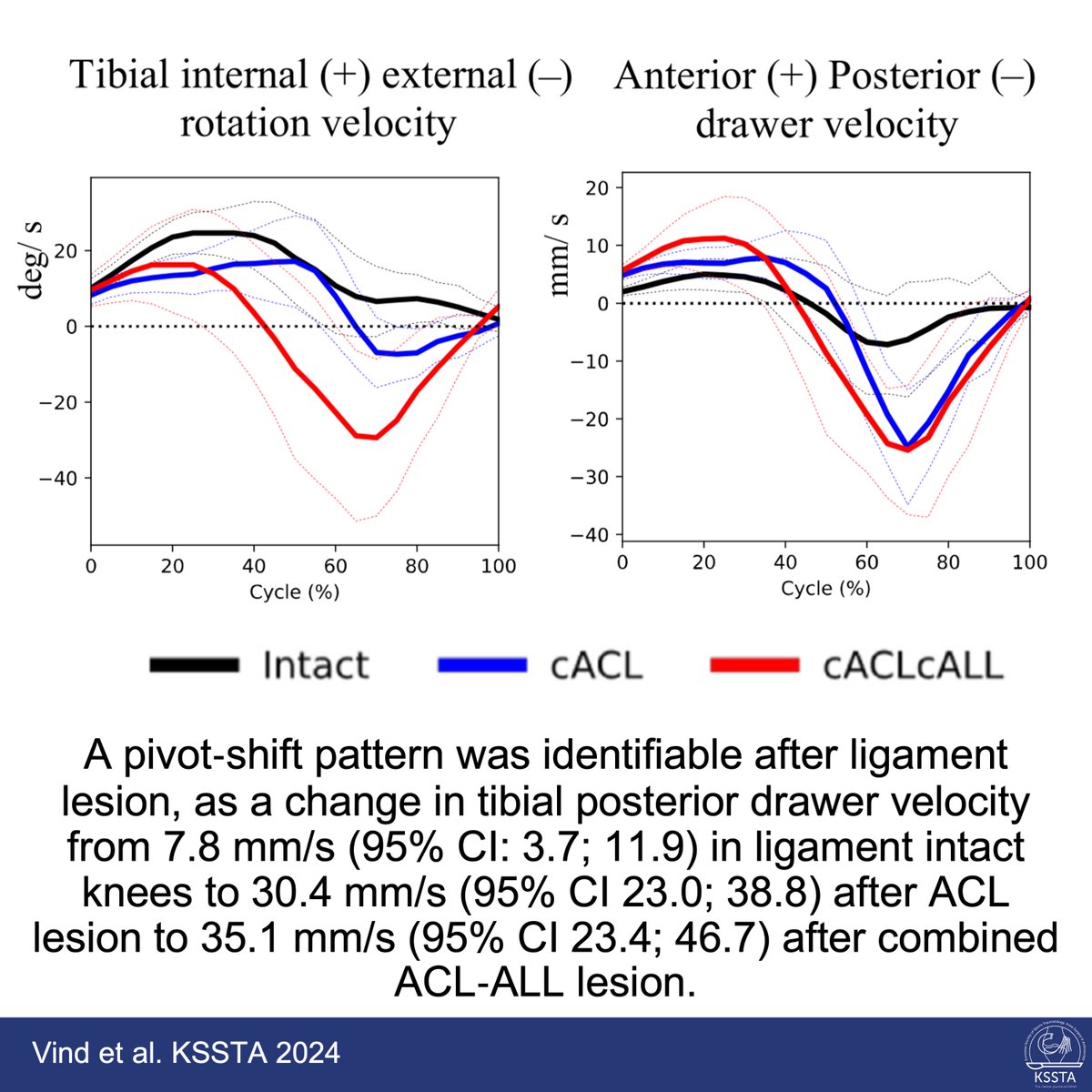 KSSTA's tweet image. Dynamic RSA might be a novel tool to reliably quantify the pivot shift test, according to this novel study.
 
#knee #biomechanics #pivotshift #diagnostics
 
Read here: doi.org/10.1002/ksa.12…