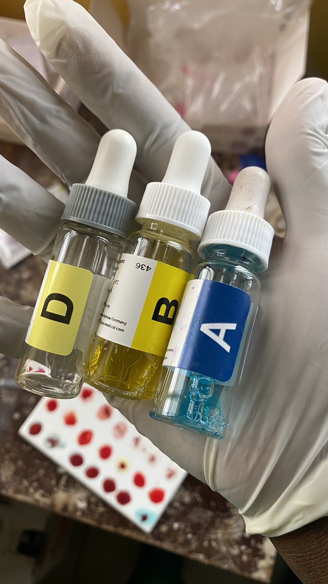 Zeeiny3's tweet image. The reagents 🩸        The scientist 

#mlscommunity