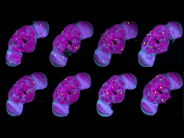 Biomedical Picture of the Day BPoD (@bpod_s) on Twitter photo Former Trauma: Early exposure to mild repetitive #headtrauma in #drosophila model – females more susceptible to #neurodegeneration later in life. Image & research by Changtian Ye et al <a href="/EmoryUniversity/">Emory University</a> in reviewed preprint <a href="/elife/">eLife - the journal</a>. On bpod.org.uk/archive/2024/6… Former Trauma: Early exposure to mild repetitive #headtrauma in #drosophila model – females more susceptible to #neurodegeneration later in life. Image & research by Changtian Ye et al <a href="/EmoryUniversity/">Emory University</a> in reviewed preprint <a href="/elife/">eLife - the journal</a>. On bpod.org.uk/archive/2024/6…
