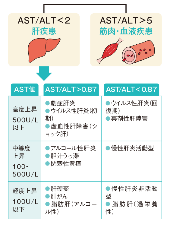 yakuzaishi_p's tweet photo. ✅検査値の勉強シリーズ

『ASTとALTの見方は？』

AST：
肝臓の他、筋肉や赤血球などにも存在
ALT：
多くが肝臓に存在

ASTの上昇だけでは
肝細胞の障害とは限らない
⇒"AST / ALT"をセットでみよう！

・アルコール性肝炎
・アルコール性脂肪肝
でAST＞ALTになりやすいのは
エタノールによるALT合成の阻害作用
が原因といわれています

看護rooさん@kango_rooの記事は
わかりやすいのでおすすめ↓↓
https://t.co/EQy1MeujXu