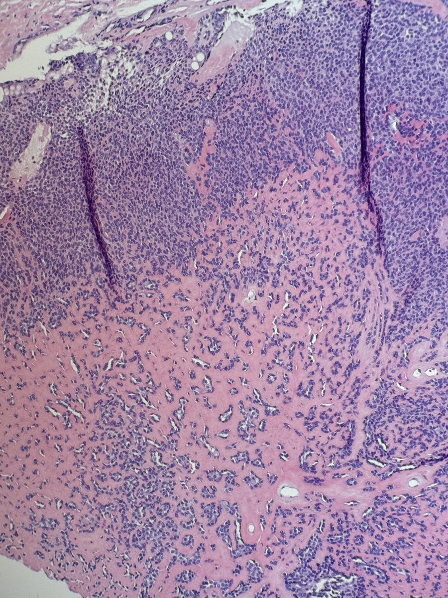 Andres Surgical Path tweet media