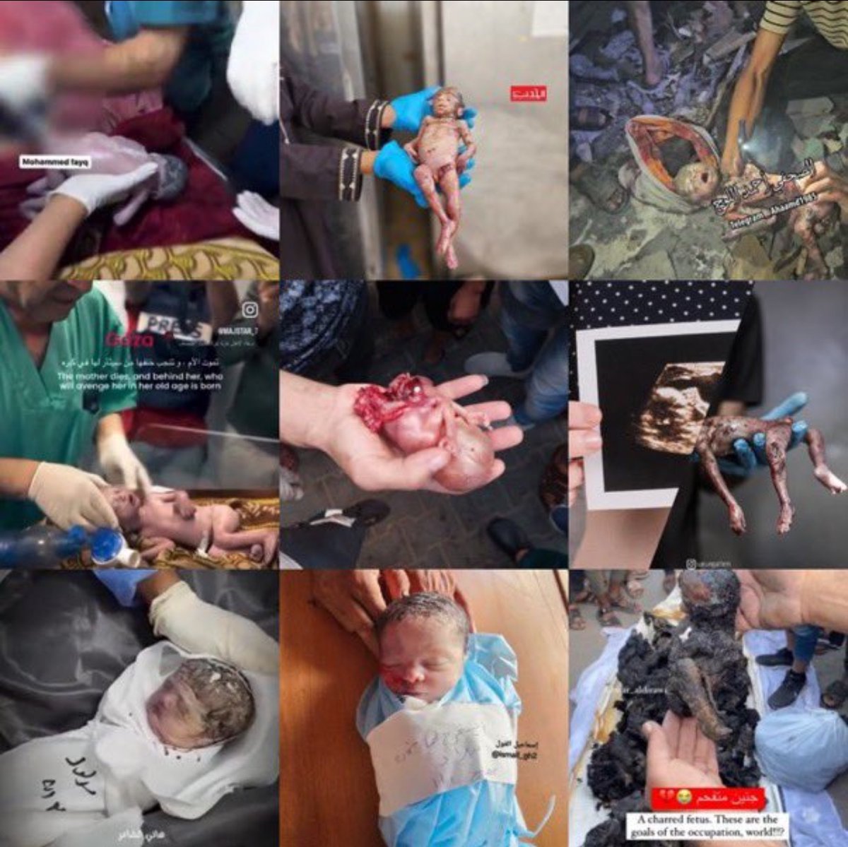 Hedaya_20's tweet photo. ISRAEL KILLED THESE BABIES BEFORE THEY WERE BORN! #شمال_غزة_يموت_جوعا $WATER #ChkChkBoom Rohit Sharma #INDvsAUS  5dd8 https://t.co/czY1DuGBAV