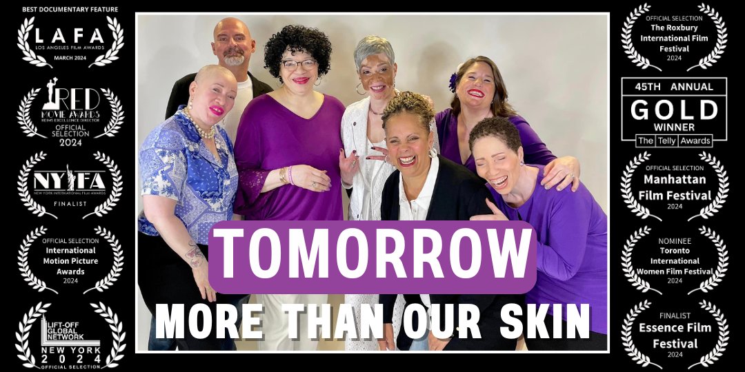 MN_vitawareness's tweet photo. We are thrilled to see you TOMORROW for the "More Than Our Skin" MN Film Premiere.  FREE tickets for the event are available: https://t.co/wRec34ydrU 
• Tuesday, 6/25
• Door open 4:30PM, film starts at 5:30
• Minneapolis ShowPlace ICON (1625 West End Blvd, St Louis Park, MN) https://t.co/kZzKOVBUTw