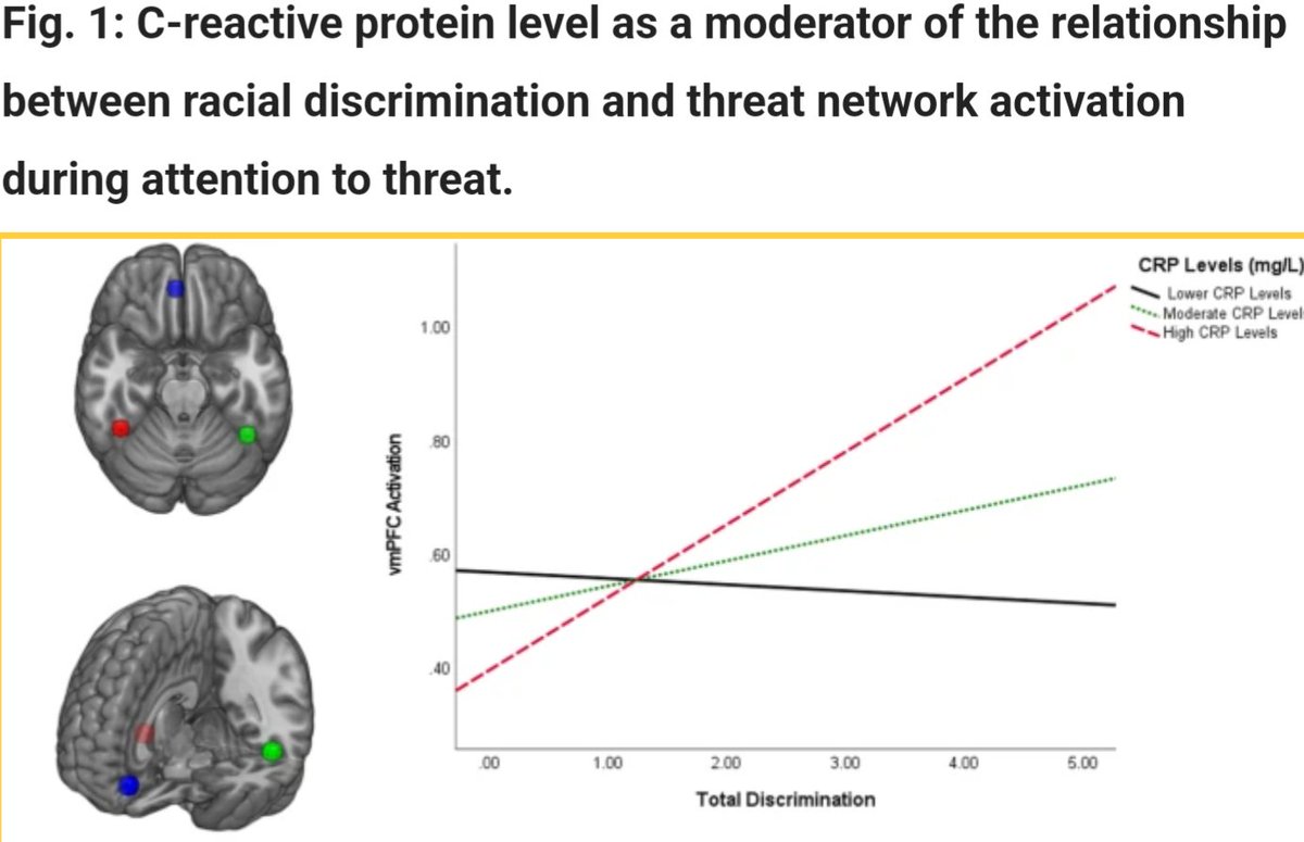 Negar Fani (@negarfani) on Twitter photo Honored to talk about our work on #racism, inflammation and threat network activation on the <a href="/npp_journal/">Neuropsychopharmacology</a> podcast with superstar PhD student <a href="/ElbasheirAziz/">Aziz Elbasheir</a> -- Cynthia was an amazing host! Honored to talk about our work on #racism, inflammation and threat network activation on the <a href="/npp_journal/">Neuropsychopharmacology</a> podcast with superstar PhD student <a href="/ElbasheirAziz/">Aziz Elbasheir</a> -- Cynthia was an amazing host!