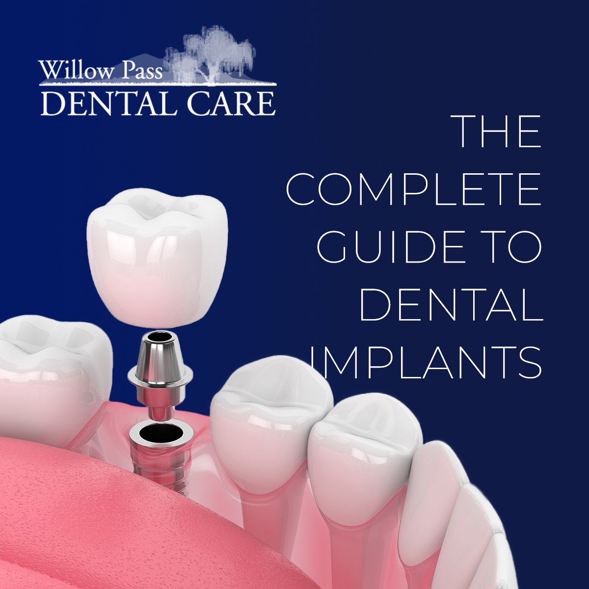 If you want to learn as much as possible about dental implants and All On 4 dental implants, you will appreciate Dr. Reza's guides.bit.ly/327Wcmx

#AllOn4DentalImplants #DentalImplants #DrRezaKhazaie #Prosthodontist #WillowPassDentalCareConcordCA #CosmeticDentistry