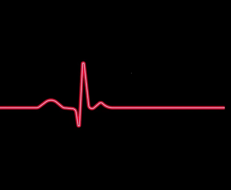 Every week in the UK, 12 people under 35 are lost unexpectedly to sudden cardiac death.

Join our free webinar at 4pm on Wednesday 26 June to find out how BHF-funded research is trying to stop this. To sign-up, visit bhf.org.uk/liventicking