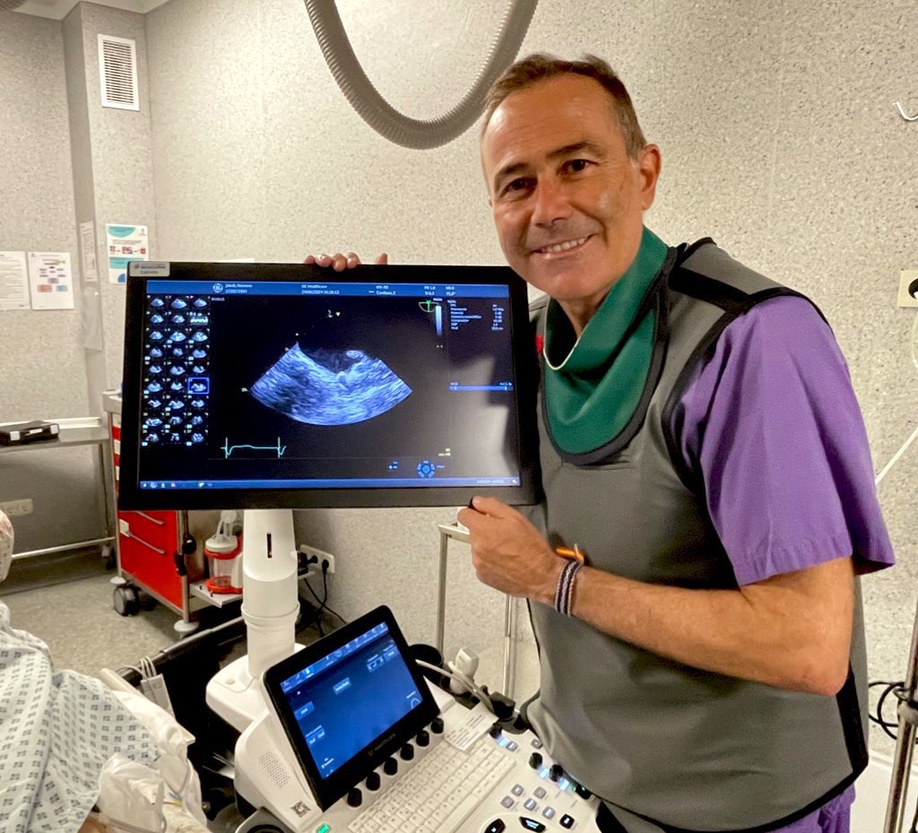 Successful closure of a giant left atrial appendage in a multipathological patient (double biological prosthesis, pacemaker with previous nodal ablation, aFib, etc) and intracranial haemorrhage with Watchman Flx 35 device 👍🏻 
Great team with a great master!!! <a href="/RuizNodarJM/">Juan Miguel Ruiz Nodar</a> 🙌🏻👏🏻🙌🏻