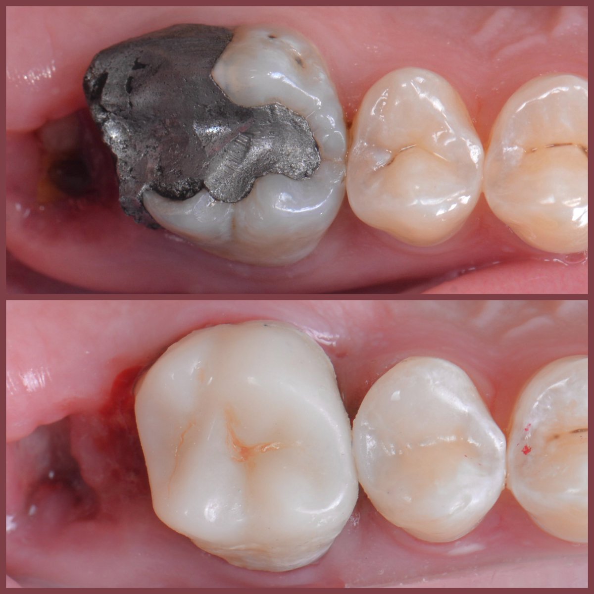 Transformation monday