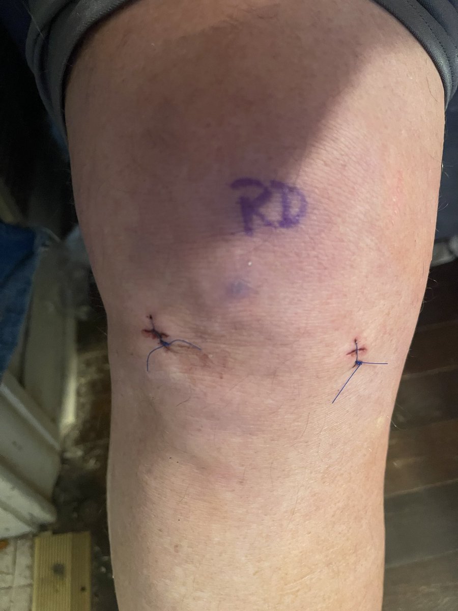 Old Coach’s Knee!