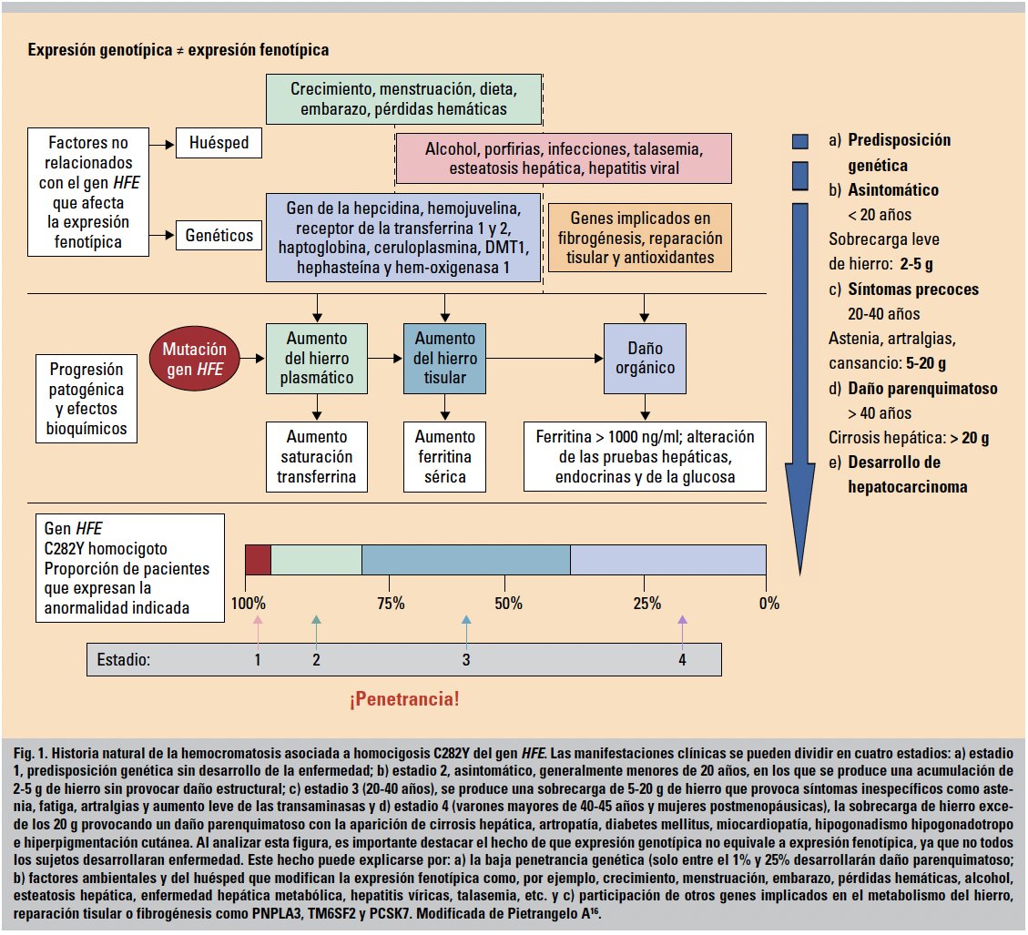 Javier Crespo (@drjaviercrespo) on Twitter photo Hemocromatosis. Una buea revisión dirigida por el Dr. Emilio Fábrega.
Historia natural de la hemocromatosis asociada a homocigosis C282Y del gen HFE.
<a href="/sepdigestiva/">Sociedad Española de Patología Digestiva (SEPD)</a> <a href="/AEEHLiver/">Asociación Española para el Estudio del Hígado</a> <a href="/DigValdecilla/">DigestivoValdecilla</a> <a href="/HUnivValdecilla/">Hospital Universitario Marqués de Valdecilla</a>
medicineonline.es/es-hemocromato… Hemocromatosis. Una buea revisión dirigida por el Dr. Emilio Fábrega.
Historia natural de la hemocromatosis asociada a homocigosis C282Y del gen HFE.
<a href="/sepdigestiva/">Sociedad Española de Patología Digestiva (SEPD)</a> <a href="/AEEHLiver/">Asociación Española para el Estudio del Hígado</a> <a href="/DigValdecilla/">DigestivoValdecilla</a> <a href="/HUnivValdecilla/">Hospital Universitario Marqués de Valdecilla</a>
medicineonline.es/es-hemocromato…