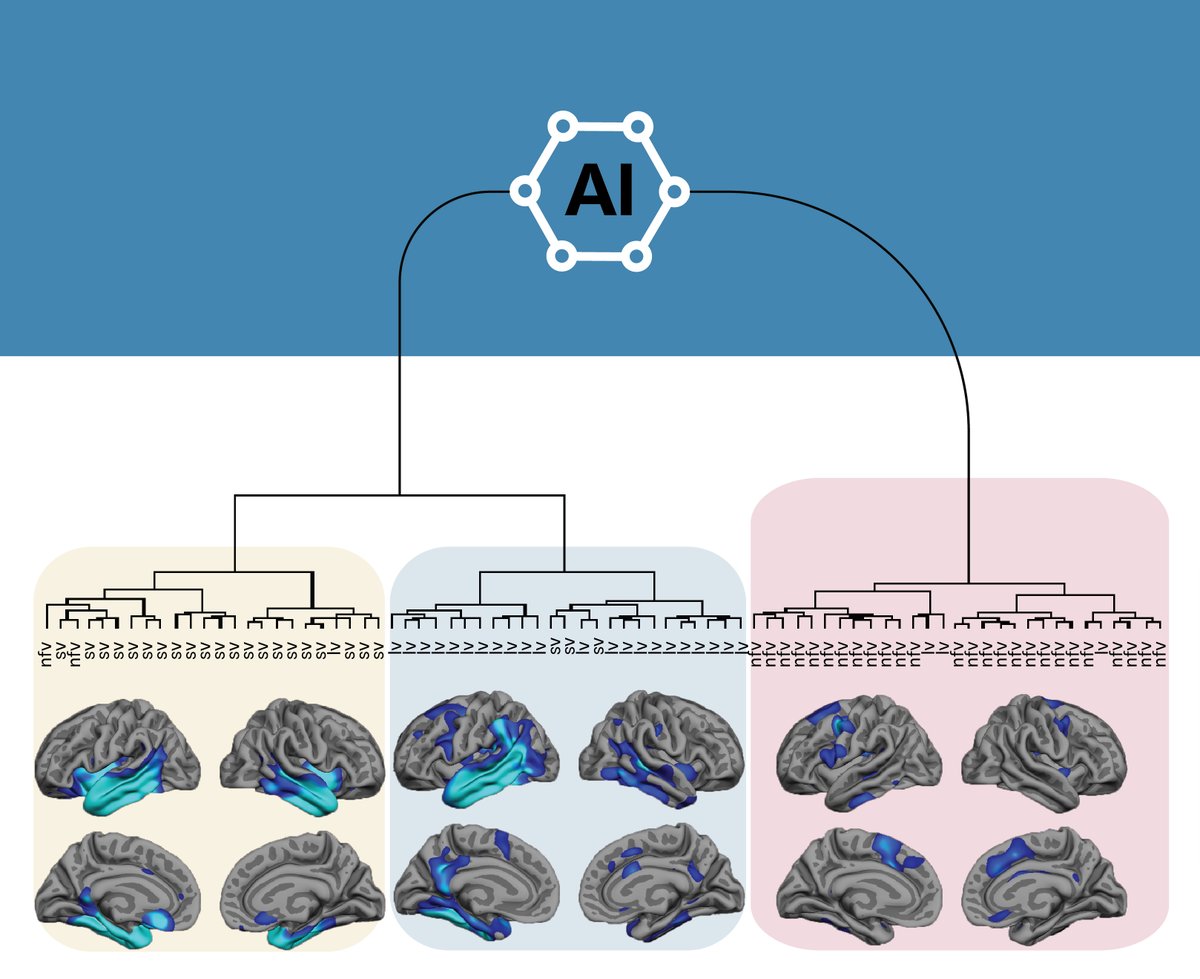 Neguine Rezaii (@neguiner) on Twitter photo Just published in Brain!
We used LLMs to classify (primary progressive aphasia) PPA in a data-driven way.
We found verb frequency is a critical variable in PPA classification. Saying "negotiate" versus "talk" makes a difference!
academic.oup.com/brain/advance-…
<a href="/DickersonLabMGH/">DickersonLabMGH</a> <a href="/PM_Wolff/">Phillip Wolff</a> Just published in Brain!
We used LLMs to classify (primary progressive aphasia) PPA in a data-driven way.
We found verb frequency is a critical variable in PPA classification. Saying "negotiate" versus "talk" makes a difference!
academic.oup.com/brain/advance-…
<a href="/DickersonLabMGH/">DickersonLabMGH</a> <a href="/PM_Wolff/">Phillip Wolff</a>