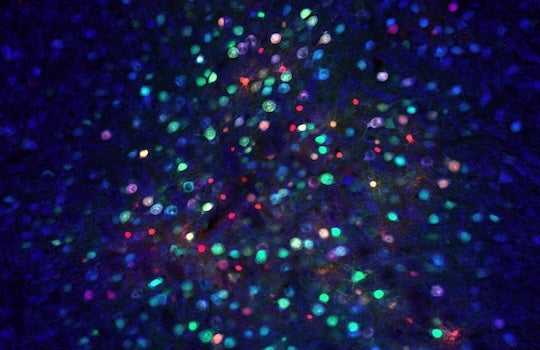 Rice University Bioengineering (@rice_bioe) on Twitter photo 🧬 🧠 Exciting news from Rice BIOE <a href="/JerzySzablowski/">Jerzy Szablowski</a> team! Their innovative gene therapy method could revolutionize brain disorder treatments by targeting specific regions with unprecedented precision. Discover more in Nature Communications! news.rice.edu/news/2024/rese… 🧬 🧠 Exciting news from Rice BIOE <a href="/JerzySzablowski/">Jerzy Szablowski</a> team! Their innovative gene therapy method could revolutionize brain disorder treatments by targeting specific regions with unprecedented precision. Discover more in Nature Communications! news.rice.edu/news/2024/rese…