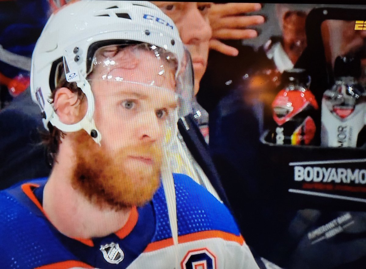 SAOilersFan91's tweet image. Pain