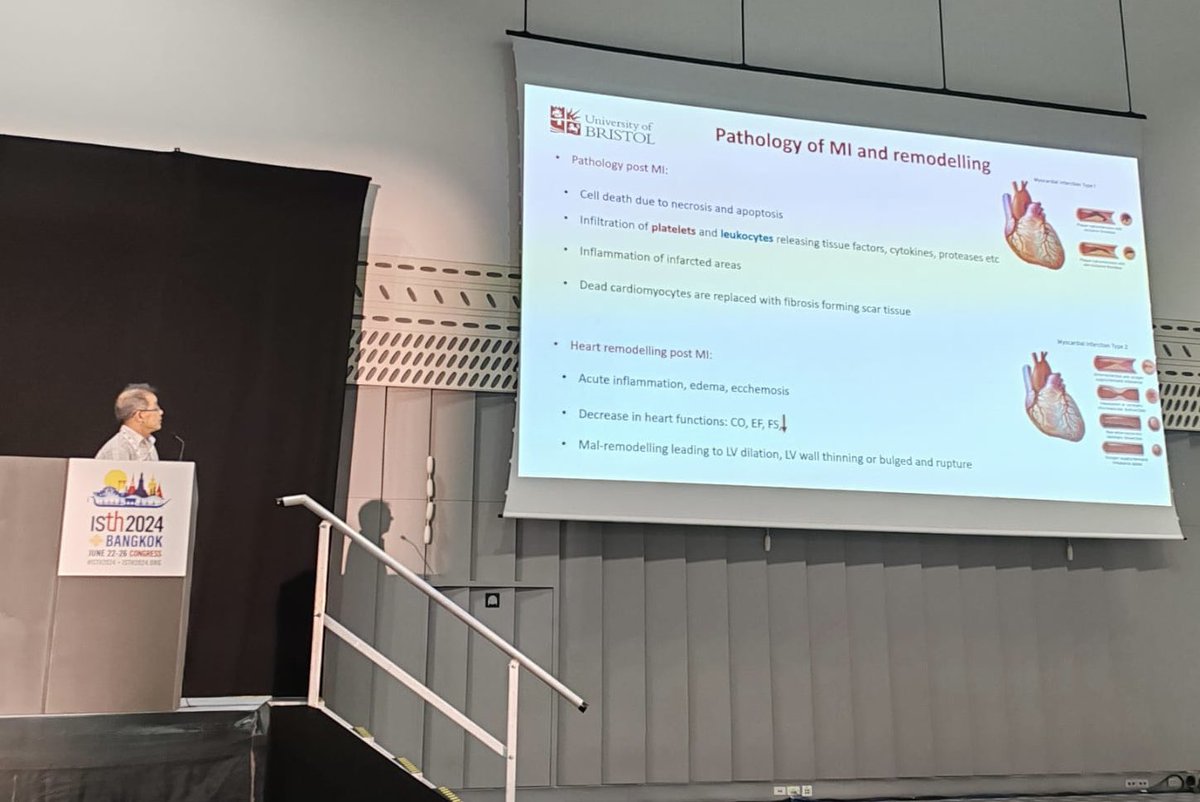 BristolPlatelet's tweet image. Great talk by our own Dr Yong Li presenting his work at #ISTH2024 in Bangkok on platelet releasate attenuating ischemic damage in acute myocardial infarction in mice. @alastair_poole @Timchico @HersIngeborg Cedric Ghevaert.