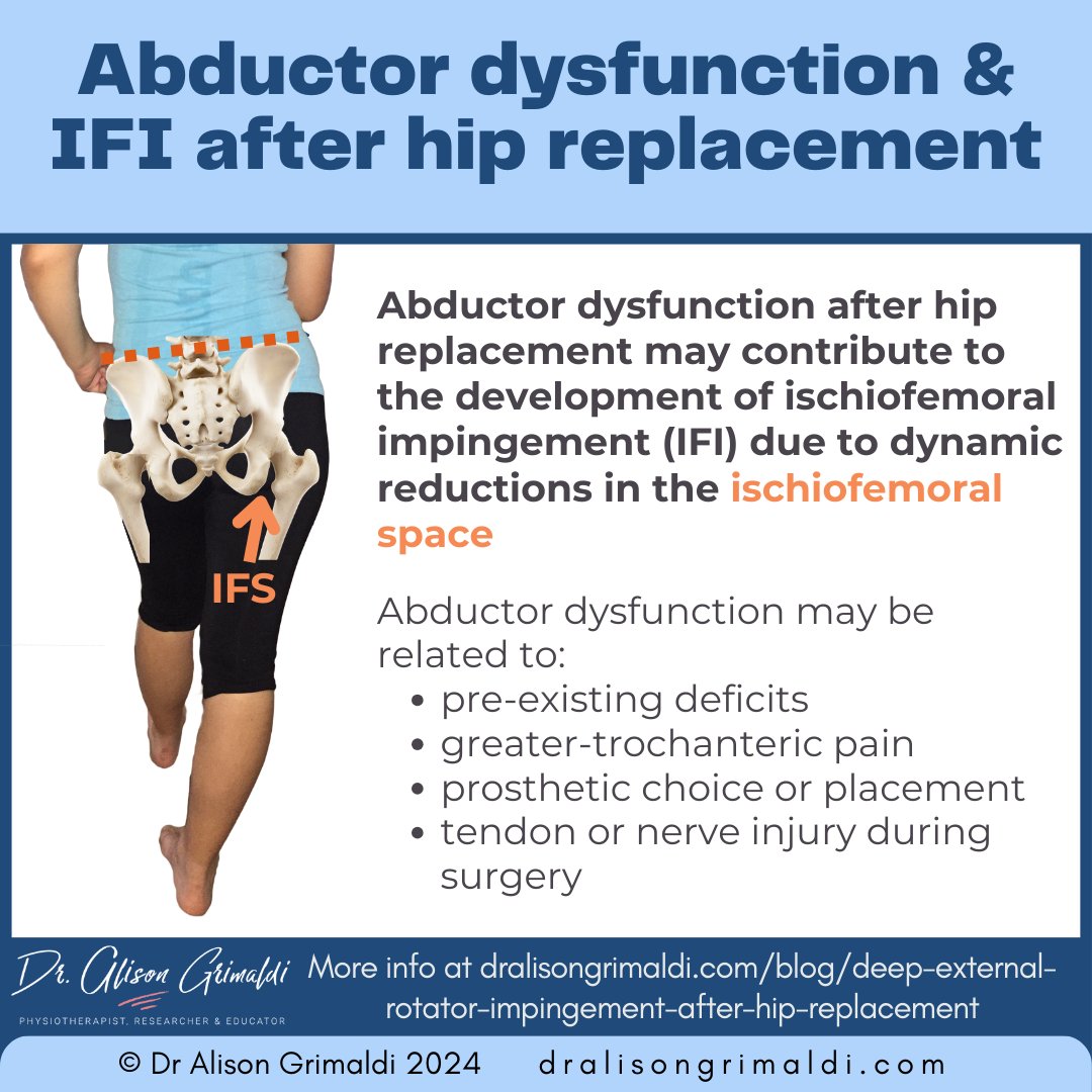 Did you know that abductor dysfunction after #THR may contribute to the development of ischiofemoral impingement #IFI due to dynamic reductions in ischiofemoral space? Read more about the factors involved: dralisongrimaldi.com/blog/deep-exte…