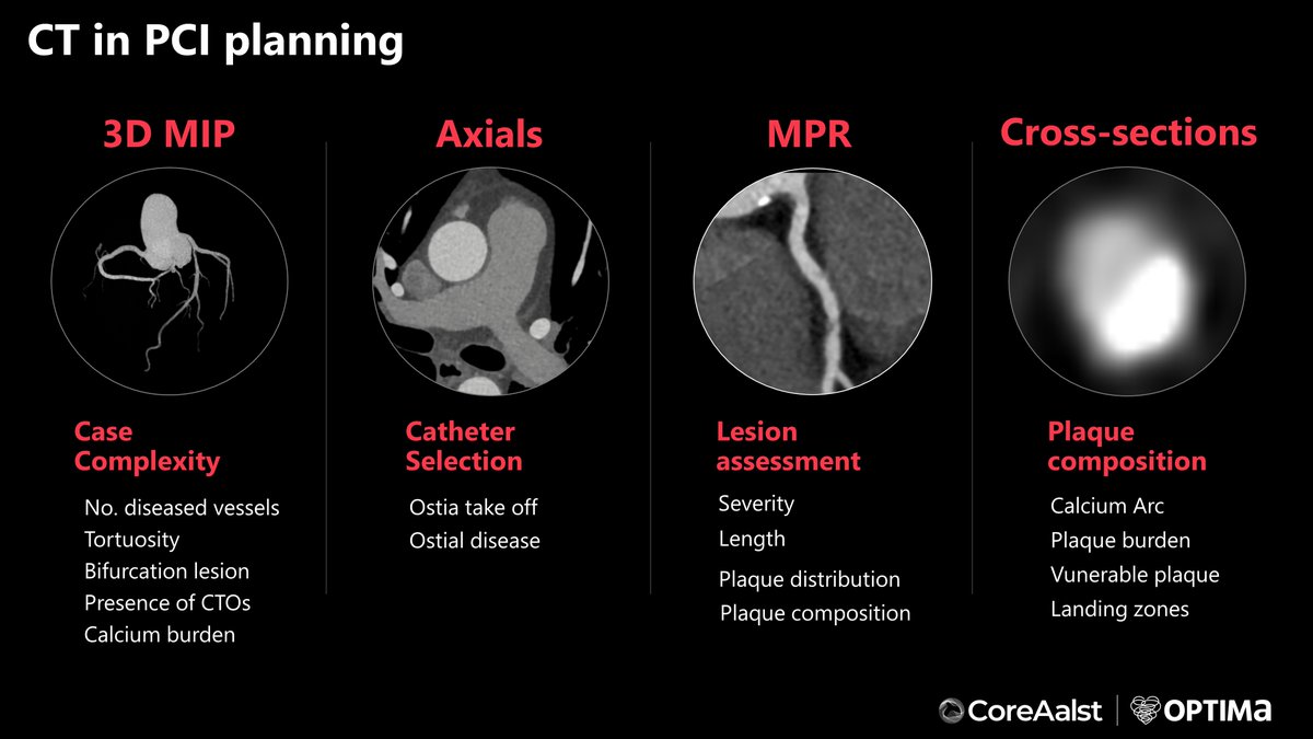 CoreAalst's tweet photo. Day 2 has kicked off! ๐#CTCourse
Dr Carlos Collet is reminding us what weโve learnt so far and all we need to know about CT. ๐คโค๏ธ
@bernardBruyne @ColletCarlos @OptimaCTO @CardioAalst @Bhcintervention @DAndreiniMD @jcspratt @OLVZaalst @ziadalinyc @DrNataliaP @hect2701 @jeroen_sonck @OPCILive @bouissetfred
@sbrugaletta @SimoneBiscaglia @said_servin @jorgeachv @EstefaniaFdezP3 @mirvatalasnag
#CTCourse #InterventionalCardiology #PCIRevolution