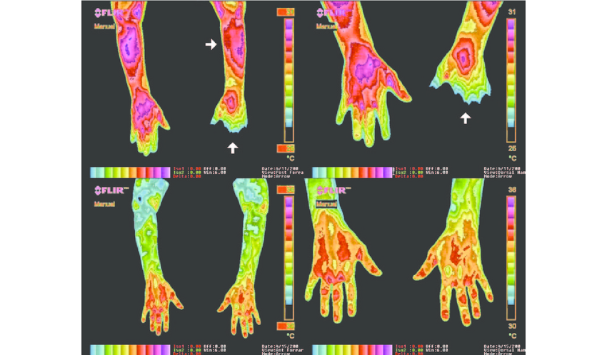 SirBarefoot's tweet photo. Grounding has been shown to:

Decrease Inflammation
Improve Blood viscosity
Speed up Recovery
Increase HRV
Regulate Cortisol
Neutralize EMF's
Support blood flow

IN DEPTH THREAD https://t.co/VeozjoGjQ0