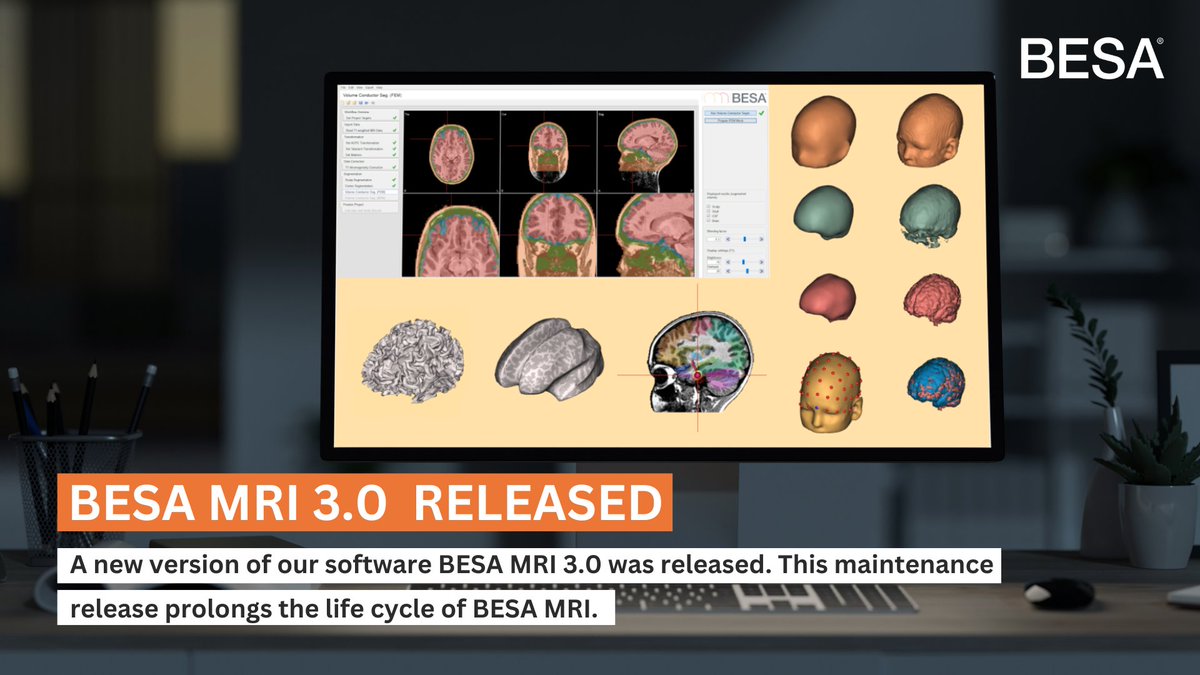 A new version of our BESA MRI 3.0 is released! This maintenance release prolongs the life cycle of BESA MRI. All users of BESA MRI 3.0 can directly download this update from our website. If you use an older version or if you are interested in getting to know BESA MRI  contact us!