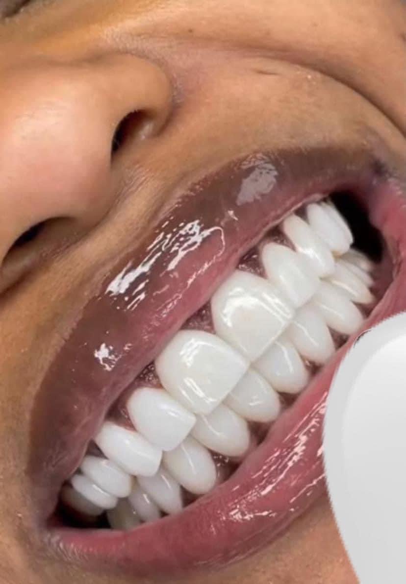 wtffolly_'s tweet image. I know y’all want the bodies but I want these