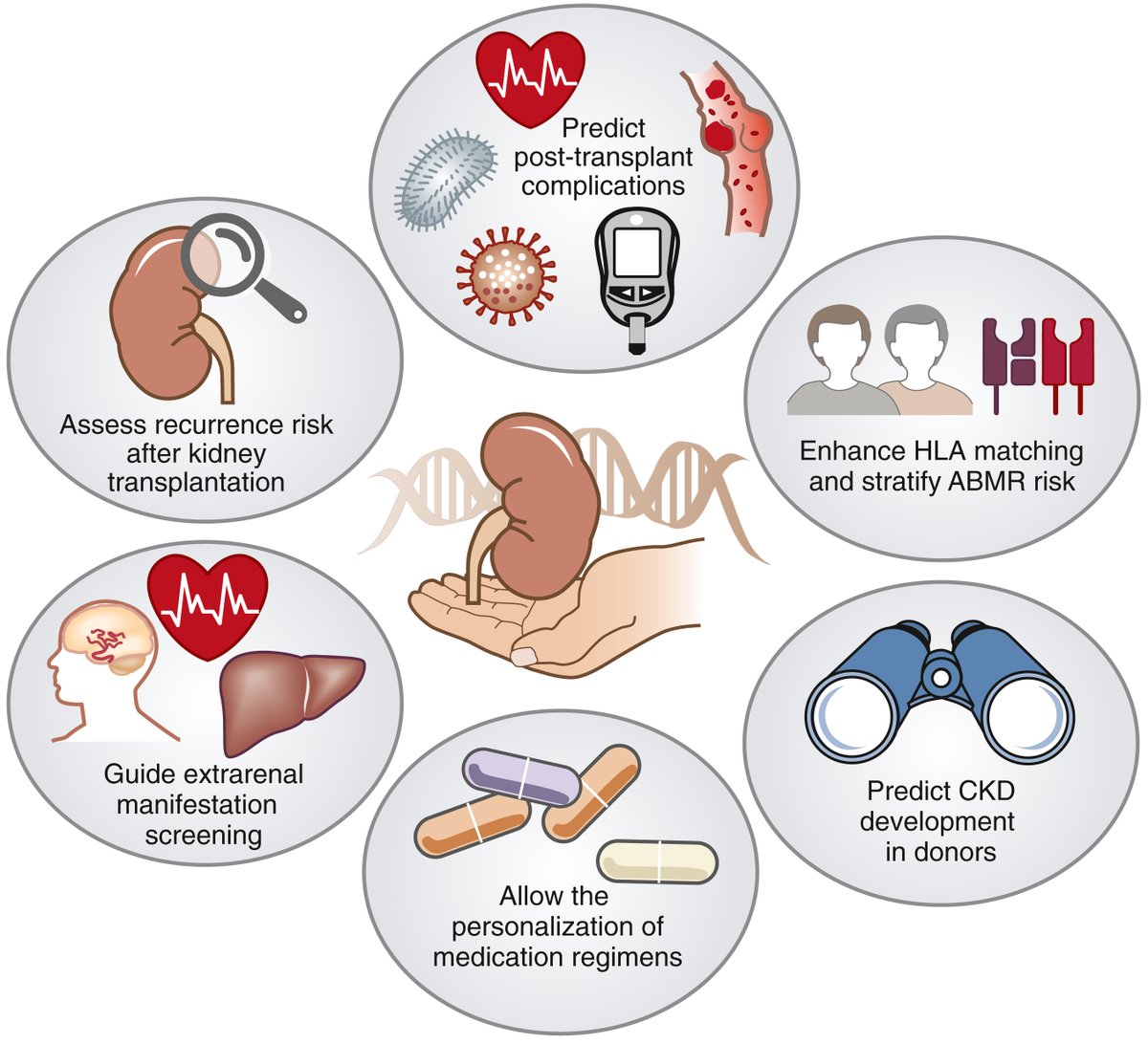 Kidney International (@kidney_int) on Twitter photo #Genomics in the #kidney transplant clinic: the future standard of care?
👉doi.org/10.1016/j.kint…
Original article: doi.org/10.1016/j.kint…
@CHRU_Brest <a href="/UBO_UnivBrest/">UBO - Univ. Brest</a> <a href="/InsermGrdOuest/">Inserm Grand Ouest</a> <a href="/TownsvilleHHS/">Townsville HHS</a> <a href="/JCUMedDent/">JCU COLLEGE OF MEDICINE & DENTISTRY</a> <a href="/IMBatUQ/">Institute for Molecular Bioscience</a>
#KICommentary #kidneytransplantation #precisionmedicine #Genomics in the #kidney transplant clinic: the future standard of care?
👉doi.org/10.1016/j.kint…
Original article: doi.org/10.1016/j.kint…
@CHRU_Brest <a href="/UBO_UnivBrest/">UBO - Univ. Brest</a> <a href="/InsermGrdOuest/">Inserm Grand Ouest</a> <a href="/TownsvilleHHS/">Townsville HHS</a> <a href="/JCUMedDent/">JCU COLLEGE OF MEDICINE & DENTISTRY</a> <a href="/IMBatUQ/">Institute for Molecular Bioscience</a>
#KICommentary #kidneytransplantation #precisionmedicine