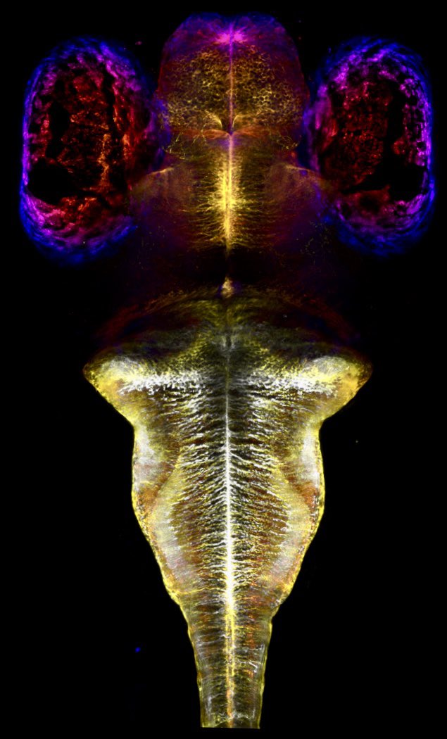 Emre Yaksi (@yaksi_emre) on Twitter photo Beautiful image (N-1 Naboo Starfighter) of our <a href="/iam_AhmedJ/">Ahmed Jamali</a> at <a href="/KISNeuro/">Kavli Neuroscience</a>, is displayed at <a href="/FENSorg/">FENS</a> Forum 2024. Ahmed is both a fantastic clinician & scientist. Visit his poster on the role of astroglia-neuron interactions in seizure prevention on 26 June afternoon, PS02-26PM-347 Beautiful image (N-1 Naboo Starfighter) of our <a href="/iam_AhmedJ/">Ahmed Jamali</a> at <a href="/KISNeuro/">Kavli Neuroscience</a>, is displayed at <a href="/FENSorg/">FENS</a> Forum 2024. Ahmed is both a fantastic clinician & scientist. Visit his poster on the role of astroglia-neuron interactions in seizure prevention on 26 June afternoon, PS02-26PM-347