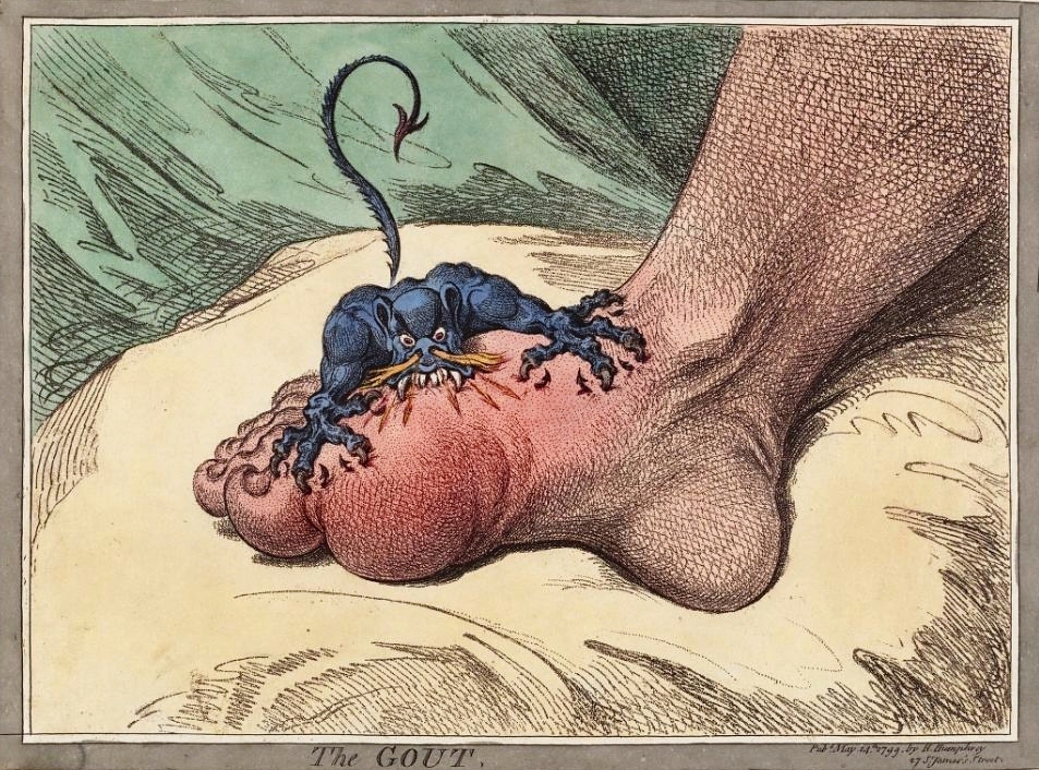 When was the word 'gout' first used? A new study traces the origin of the word to the 10th century, challenging long-held beliefs. 
reumatismo.org/reuma/article/…