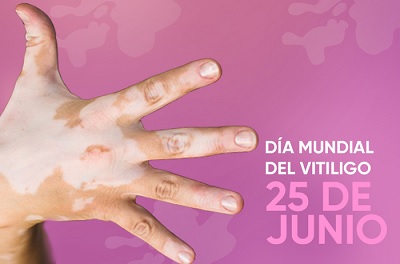 El Día Mundial del Vitiligo, que se celebra cada 25 de junio, es una iniciativa destinada a crear conciencia mundial sobre esta afección. #EducaciónQuivicán #EducaciónMayabeque