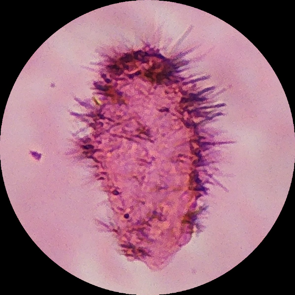 SyedSal55391459's tweet photo. #histopathology
#photomicrography
#art
#path Twitter
Artifact in a histopathology slide.
Looks like a cactus.
(Filter used in the second picture)
Art in Pathology.
Pathology is the ocean of art in addition to giving diagnosis of diseases.
Love for Pathologists of the world https://t.co/Gc1EI2M2It