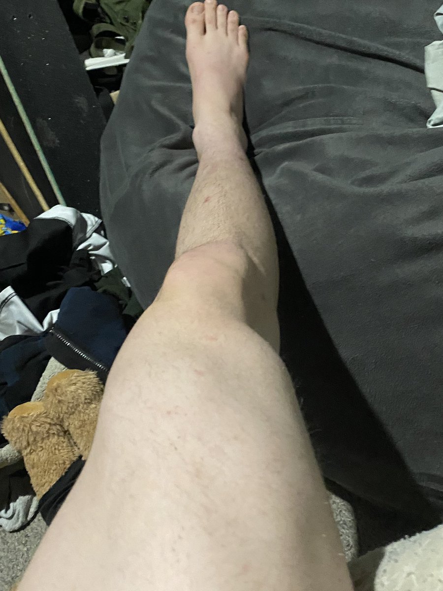 kingkashflow_'s tweet photo. I bet you wish you were under my smelly feet instead😈🦶But anyways… who wants to buy my dinner tonight🌭😈💪🏼

:/:/:/:/:/:/:/:/:/:/:/:/:/:/:/:/:/:/:/:/:/:/:/:/:/:/:/:/
#findom #ALPHA #cashapp #cashslave #sweatyfeet #worship #cashfag #footslave https://t.co/3cYcs0lqs7