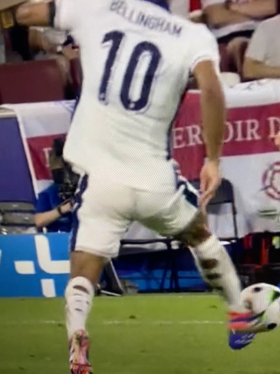 Wieso schneiden sich einige Spieler eigentlich hinten Löcher in die Stutzen? Hab ich jetzt schon häufiger gesehen. Lüftungslöcher? Sonst zu eng? Sieht stylisch aus? Was? #euro2024 #engsvn