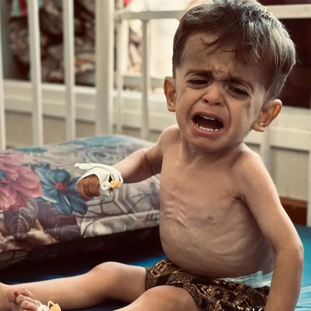 Four children have starved to death this week in Gaza, where a new UN report has revealed the extent of the forced hunger crisis imposed by Israel in its ongoing genocide in Gaza.
#GazaGenocide #NetanyahuWarCriminal #AbandonBiden #FreePalestine 🇵🇸🙏🇵🇸