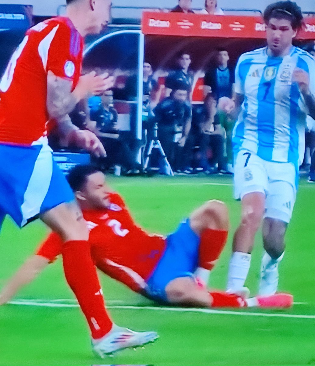 JuliAndres68's tweet photo. Así cualquiera es campeon po, Argentina sin el arbitraje comprado No es nada.  #VamosChile #Chile #CopaAmérica2024 https://t.co/6AE9YC5mah
